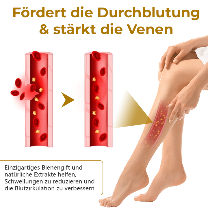 Timilk® VeinClear Bienengiftcreme |✨ Sichtbare Linderung in nur 7 Tagen! 🦵🌿