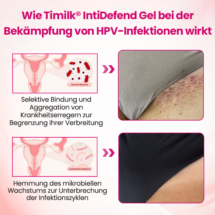 Timilk® IntiDefend Anti-HPV Interferon-Gel