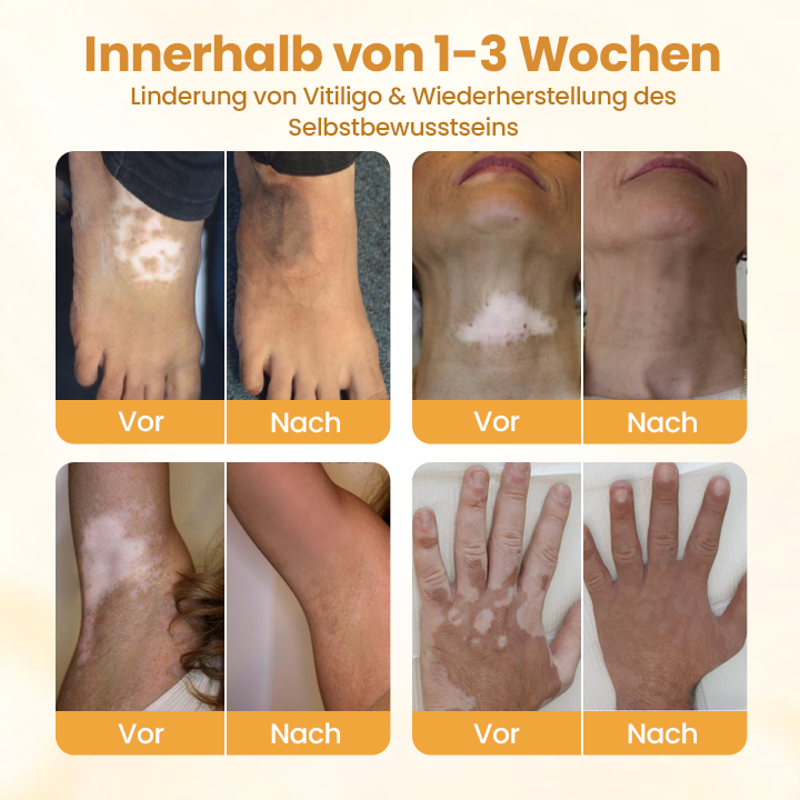 Timilk® VitiCalm Bienengift-Creme