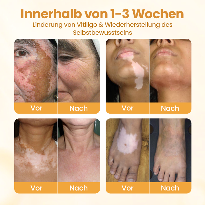 Timilk® VitiCalm Bienengift-Creme