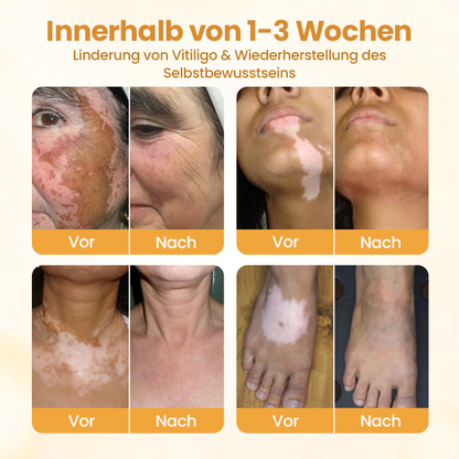 Timilk® VitiCalm Bienengift-Creme