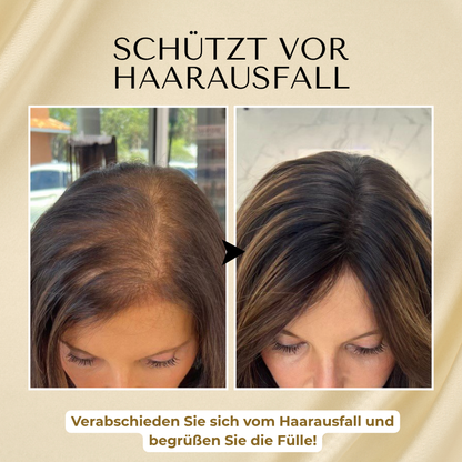 Timilk® VitaStrand Biotin Haarwachstumsspray