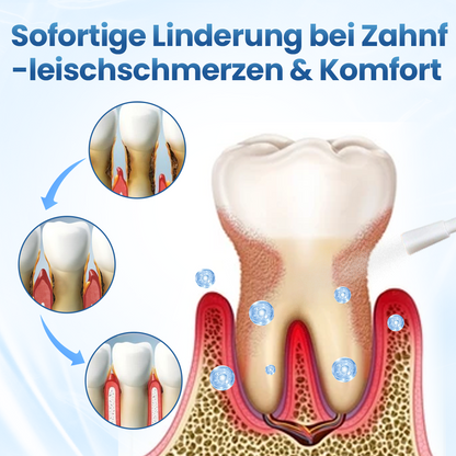 Timilk® GumRelief Natürliches Spray