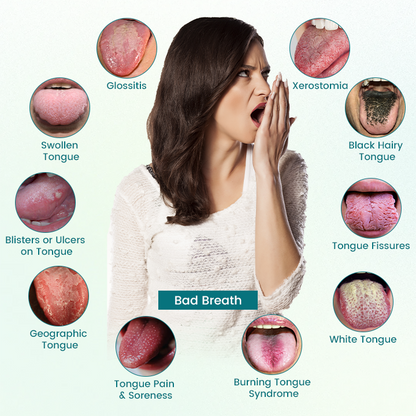 Timilk® GlosShield Zungenreparaturspray