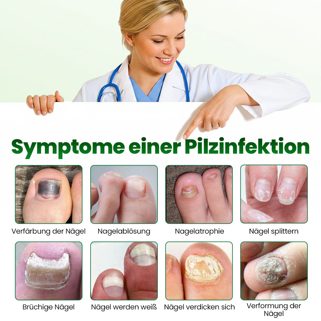 Timilk® HerbaNail 7-Tage Repair-Serum 🔥 FDA-zertifiziert (Klinisch bewährte Kräuterformel für 7-Tage-Nagelpilz-Reparatur & Stärkungsaufbau 🌿)