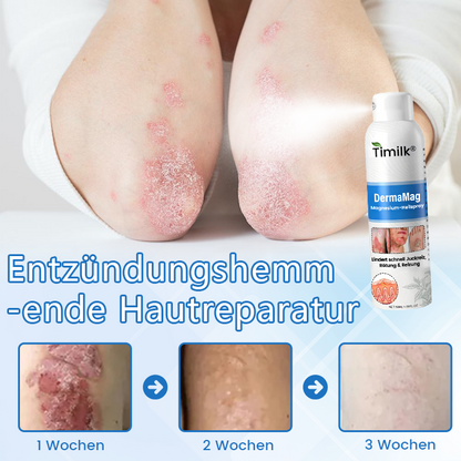✅ Offizieller Shop: Timilk® DermaMag Magnesium-Reparaturspray 🔥 FDA-zertifiziert (klinisch nachgewiesene Linderung bei Psoriasis, Ekzemen und chronischen Hautirritationen 🌿)