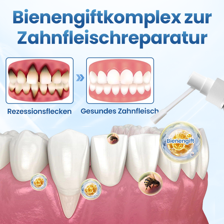 Timilk® GumRelief Natürliches Spray