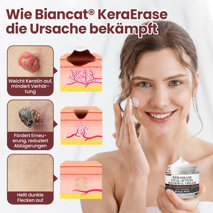 Biancat® KeraErase Dual-Action Erneuerungscreme-