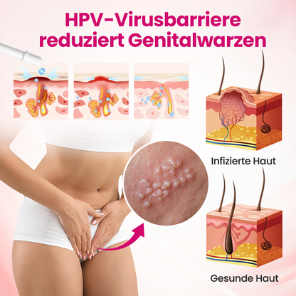 Timilk® IntiDefend Anti-HPV Interferon-Gel