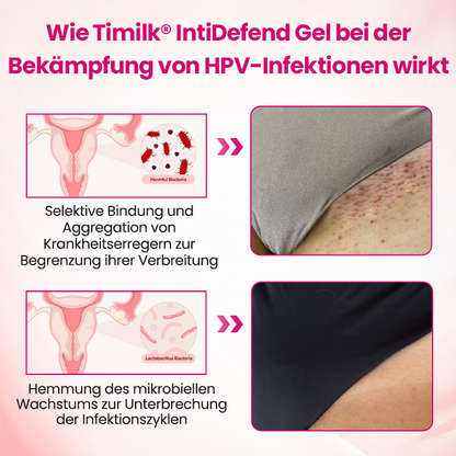 Timilk® IntiDefend Anti-HPV Interferon-Gel