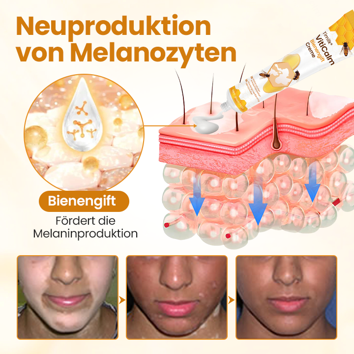 Timilk® VitiCalm Bienengift-Creme