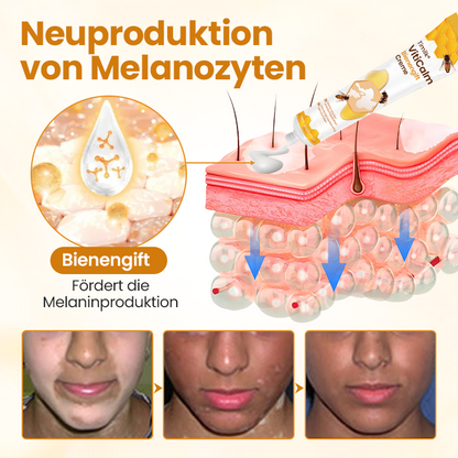 Timilk® VitiCalm Bienengift-Creme