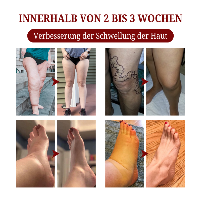 Biancat® SwellCare Lymphatische Massagecreme upsell YQ