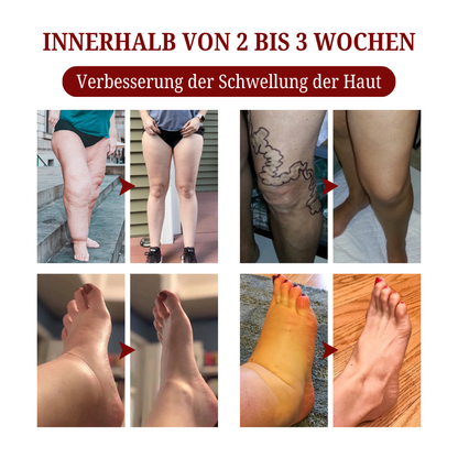 Biancat® SwellCare Lymphatische Massagecreme upsell YQ