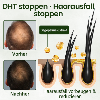 Timilk® Follicure BioGrow Haarwiederherstellungs-Spray (Wecken Sie Ihre Haarwurzeln. Natürlicher Haarwuchs. ✨ Klinisch nachgewiesener Haarwuchs innerhalb von 4 Wochen ✨)