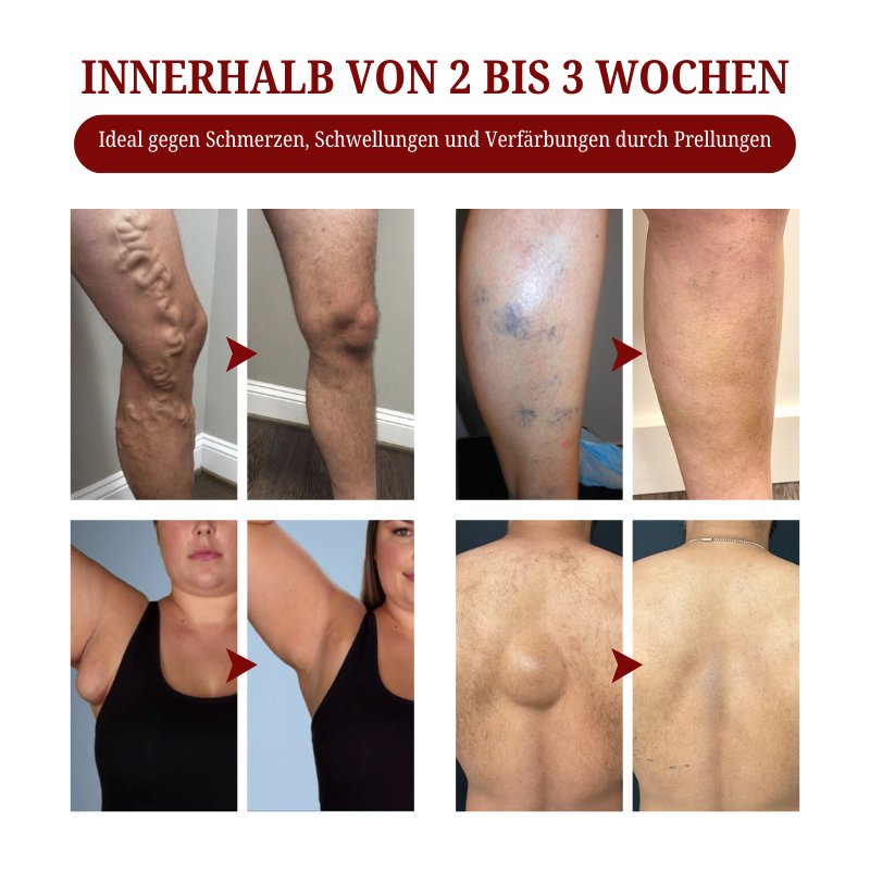 Biancat® SwellCare Lymphatische Massagecreme upsell YQ