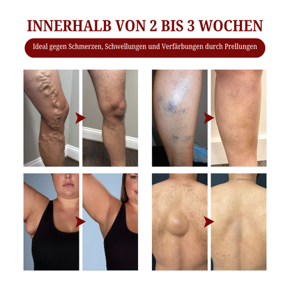 Biancat® SwellCare Lymphatische Massagecreme upsell YQ