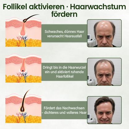 Timilk® Follicure BioGrow Haarwiederherstellungs-Spray (Wecken Sie Ihre Haarwurzeln. Natürlicher Haarwuchs. ✨ Klinisch nachgewiesener Haarwuchs innerhalb von 4 Wochen ✨)