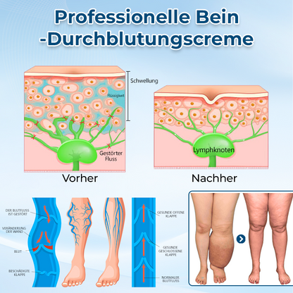 ✅ Offizieller Shop: Timilk® LymphoEase Magnesium PCA Roll-On Linderungscreme 🔥 FDA-zertifiziert (Klinisch erwiesene Linderung bei Lymphödemen, Beinschwellungen und schlechter Durchblutung 🩺)