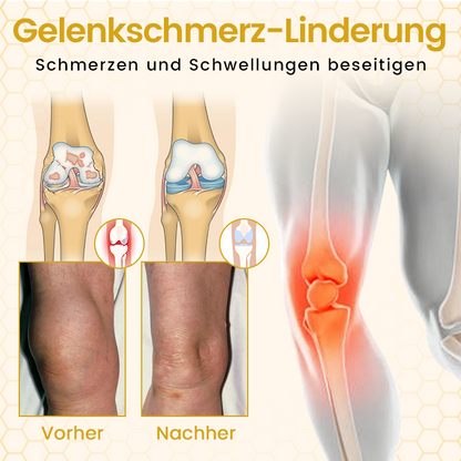 Timilk® VenomFlex Bienen-Therapiecreme