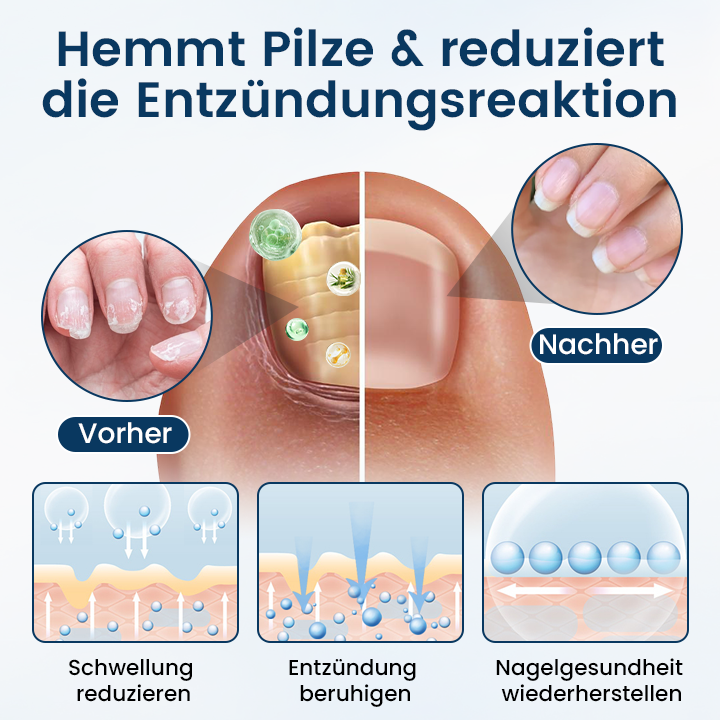 Timilk® OnyxiGuard Kräuter-Spray zur Pilzbehandlung