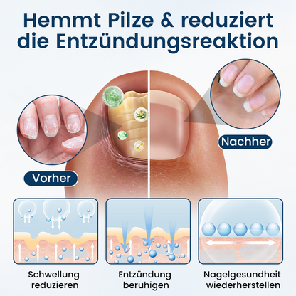 Timilk® OnyxiGuard Kräuter-Spray zur Pilzbehandlung
