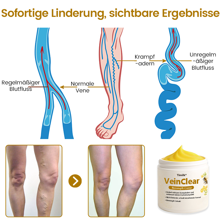 Timilk® VeinClear Bienengiftcreme |✨ Sichtbare Linderung in nur 7 Tagen! 🦵🌿