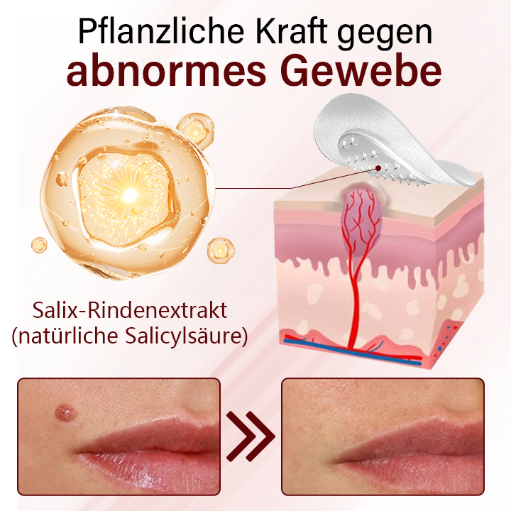 Timilk® Vionara Nano Warzenentfernungs-Pflaster