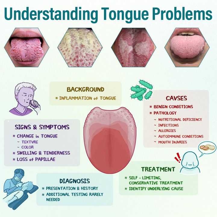 Timilk® GlosShield Zungenreparaturspray