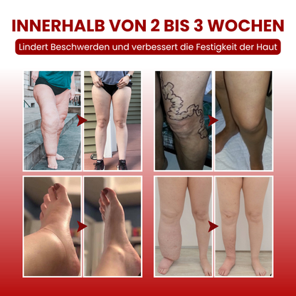 Timilk® SwellCare Professionelle Lymphdrainage-Massagecreme