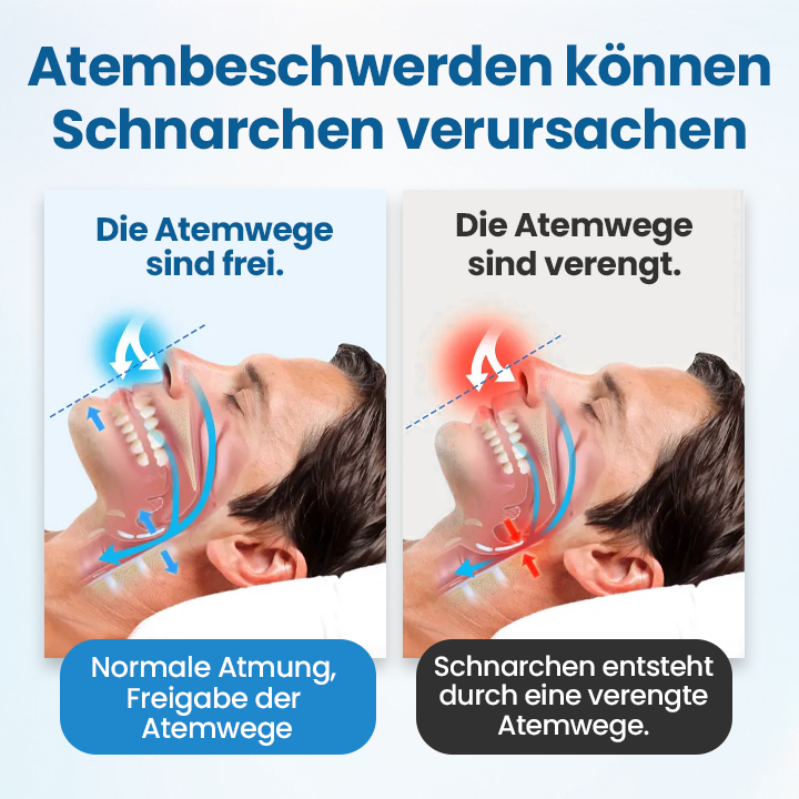 Timilk® SnoreLess Nasenatmungshelfer