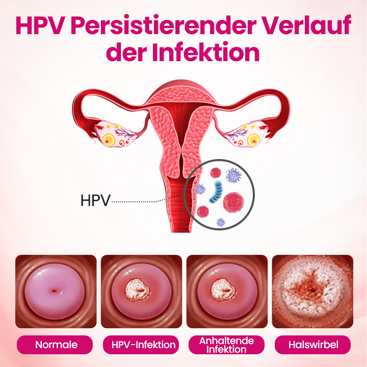 Timilk® IntiDefend Anti-HPV Interferon-Gel