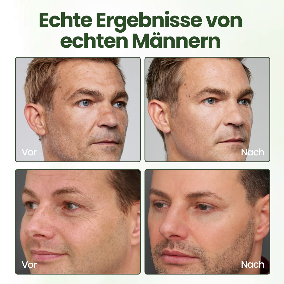 Biancat® FortiTallow Anti-Falten-Balsam