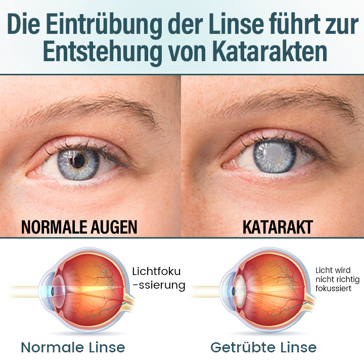 Timilk® OptiFusion Nano Augentropfen-Serum