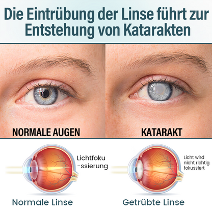 Timilk® OptiFusion Nano Augentropfen-Serum