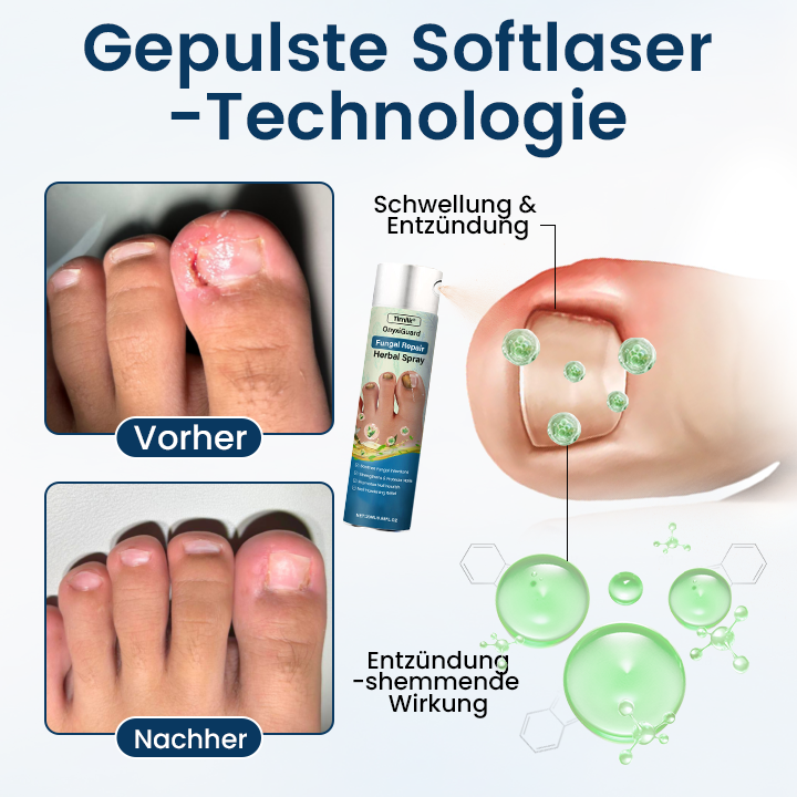 Timilk® OnyxiGuard Kräuter-Spray zur Pilzbehandlung