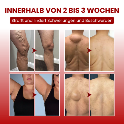 Timilk® SwellCare Professionelle Lymphdrainage-Massagecreme