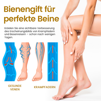 Timilk® VeinClear Bienengiftcreme |✨ Sichtbare Linderung in nur 7 Tagen! 🦵🌿
