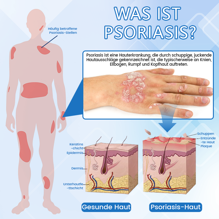 ✅ Offizieller Shop: Timilk® DermaMag Magnesium-Reparaturspray 🔥 FDA-zertifiziert (klinisch nachgewiesene Linderung bei Psoriasis, Ekzemen und chronischen Hautirritationen 🌿)