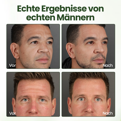 Biancat® FortiTallow Anti-Falten-Balsam