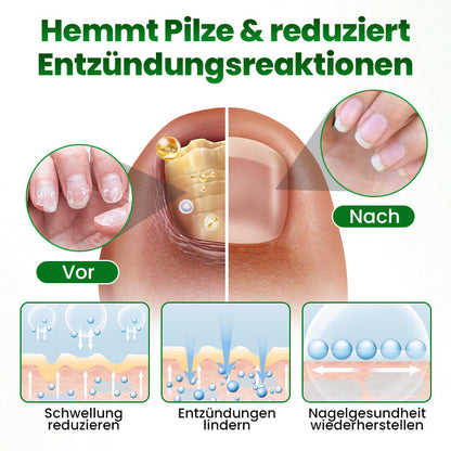 Timilk® HerbaNail 7-Tage Repair-Serum 🔥 FDA-zertifiziert (Klinisch bewährte Kräuterformel für 7-Tage-Nagelpilz-Reparatur & Stärkungsaufbau 🌿)