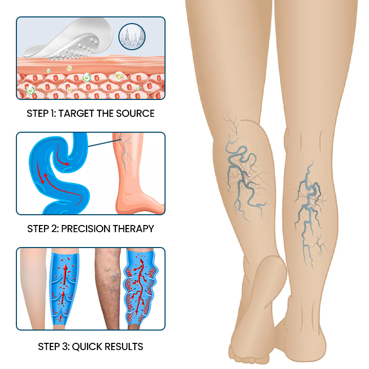 Timilk® VeinFlow Microneedle Repair Patch