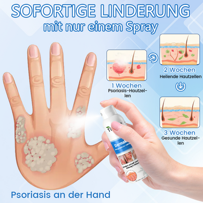 ✅ Offizieller Shop: Timilk® DermaMag Magnesium-Reparaturspray 🔥 FDA-zertifiziert (klinisch nachgewiesene Linderung bei Psoriasis, Ekzemen und chronischen Hautirritationen 🌿)