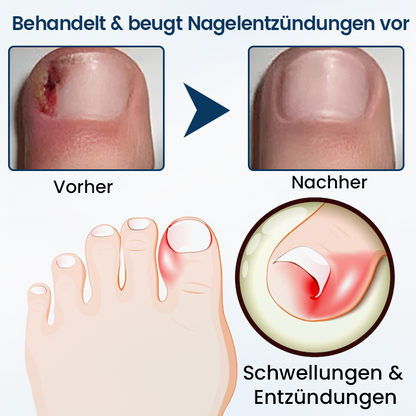 Timilk® OnyxiGuard Kräuter-Spray zur Pilzbehandlung