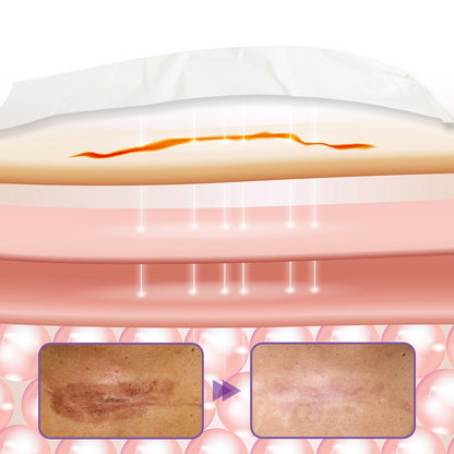 Timilk® HyaRepair Mikronadel-Hautpflaster