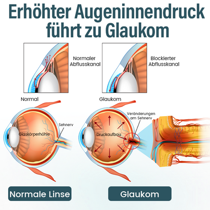 Timilk® OptiFusion Nano Augentropfen-Serum