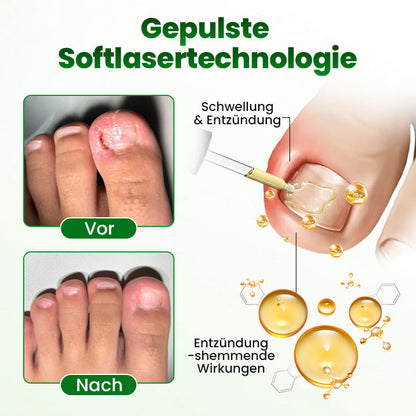 Timilk® HerbaNail 7-Tage Repair-Serum 🔥 FDA-zertifiziert (Klinisch bewährte Kräuterformel für 7-Tage-Nagelpilz-Reparatur & Stärkungsaufbau 🌿)