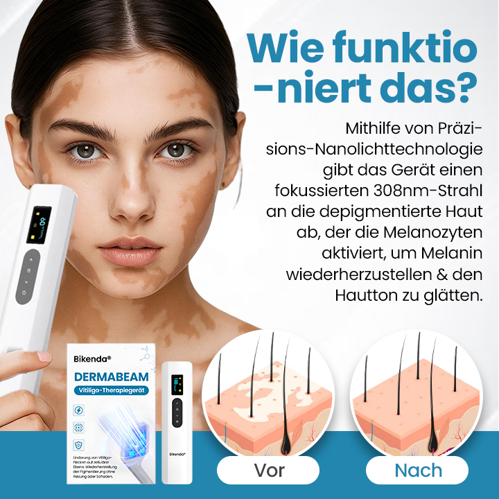 Bikenda® DermaBeam Vitiligo-Therapiegerät