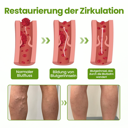 Timilk® VeinEase Beinmaske