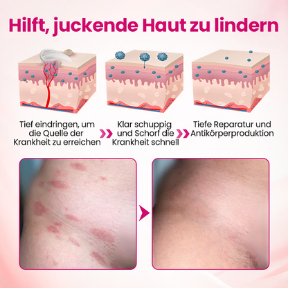 Timilk® IntiDefend Anti-HPV Interferon-Gel